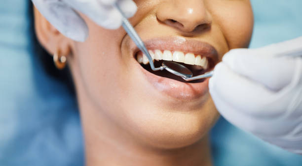 Best Lost Filling or Crown Replacement in Benavides, TX