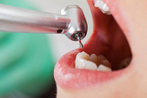Best Broken or Chipped Tooth Repair in Benavides, TX